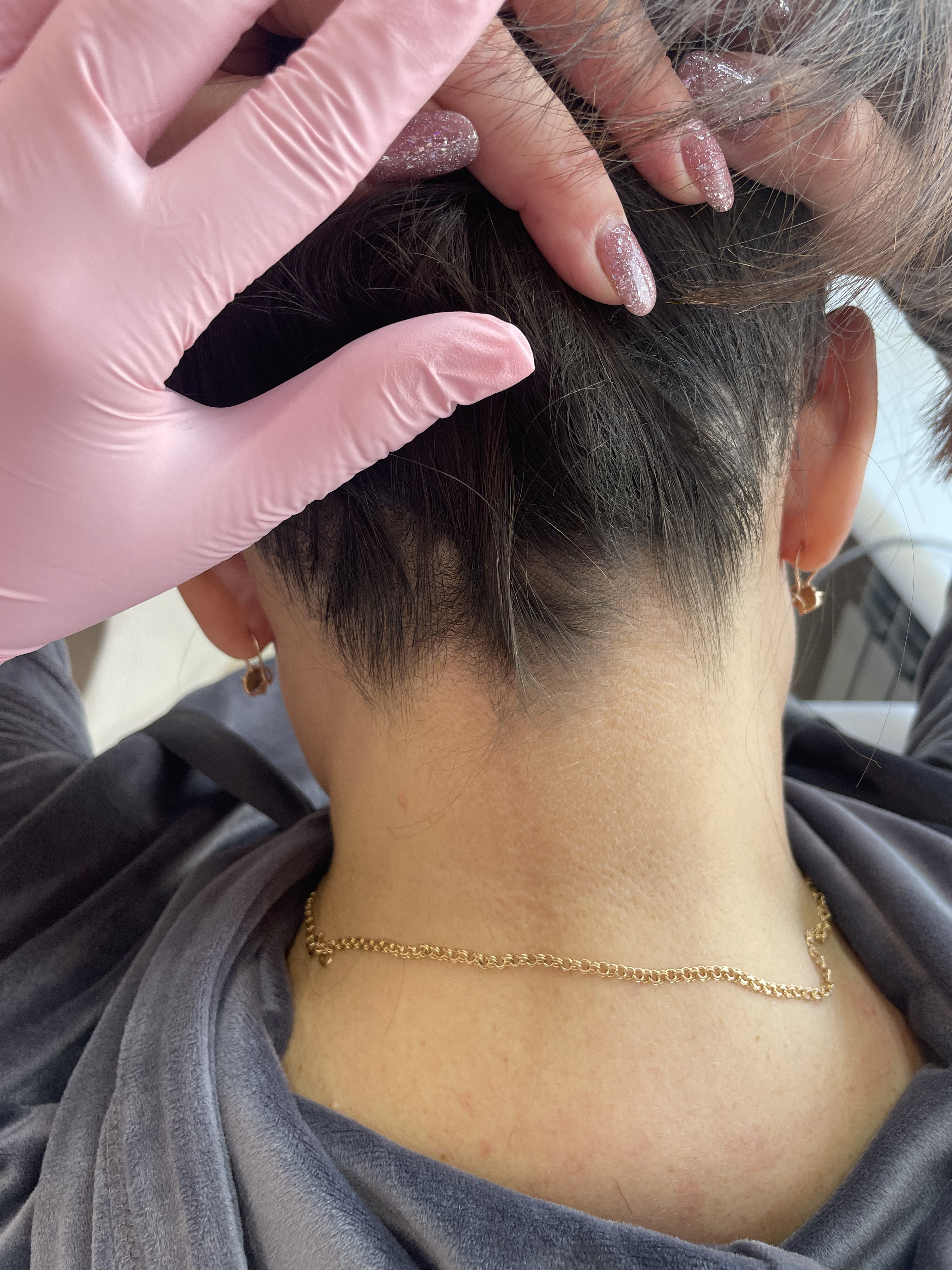 Після процедури