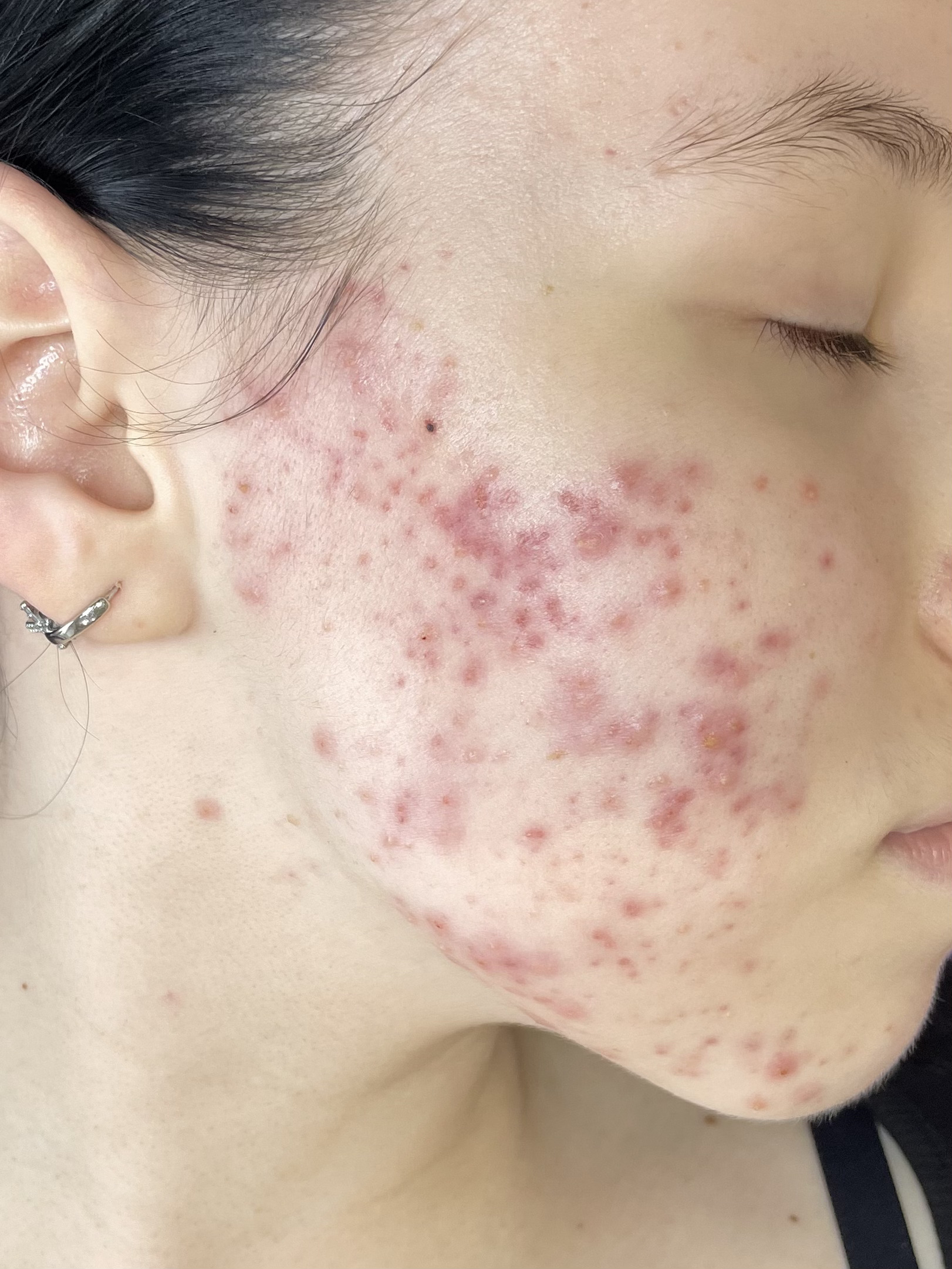 До процедури